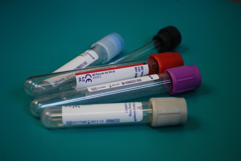 Podstawowe badania krwi – jakie?